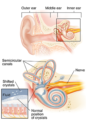 Inner Ear Problems: Causes of Dizziness (Vertigo) | Spectrum Health Lakeland