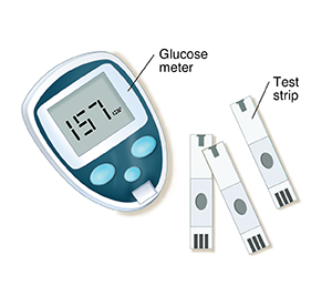 Diabetes and Your Child: Checking Blood Sugar | Spectrum Health Lakeland